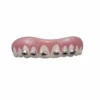 Swedia's Prosthetics Braces - Billy Bob Teeth
